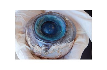 Un occhio misterioso trovato in Florida