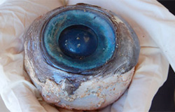 Un occhio misterioso trovato in Florida